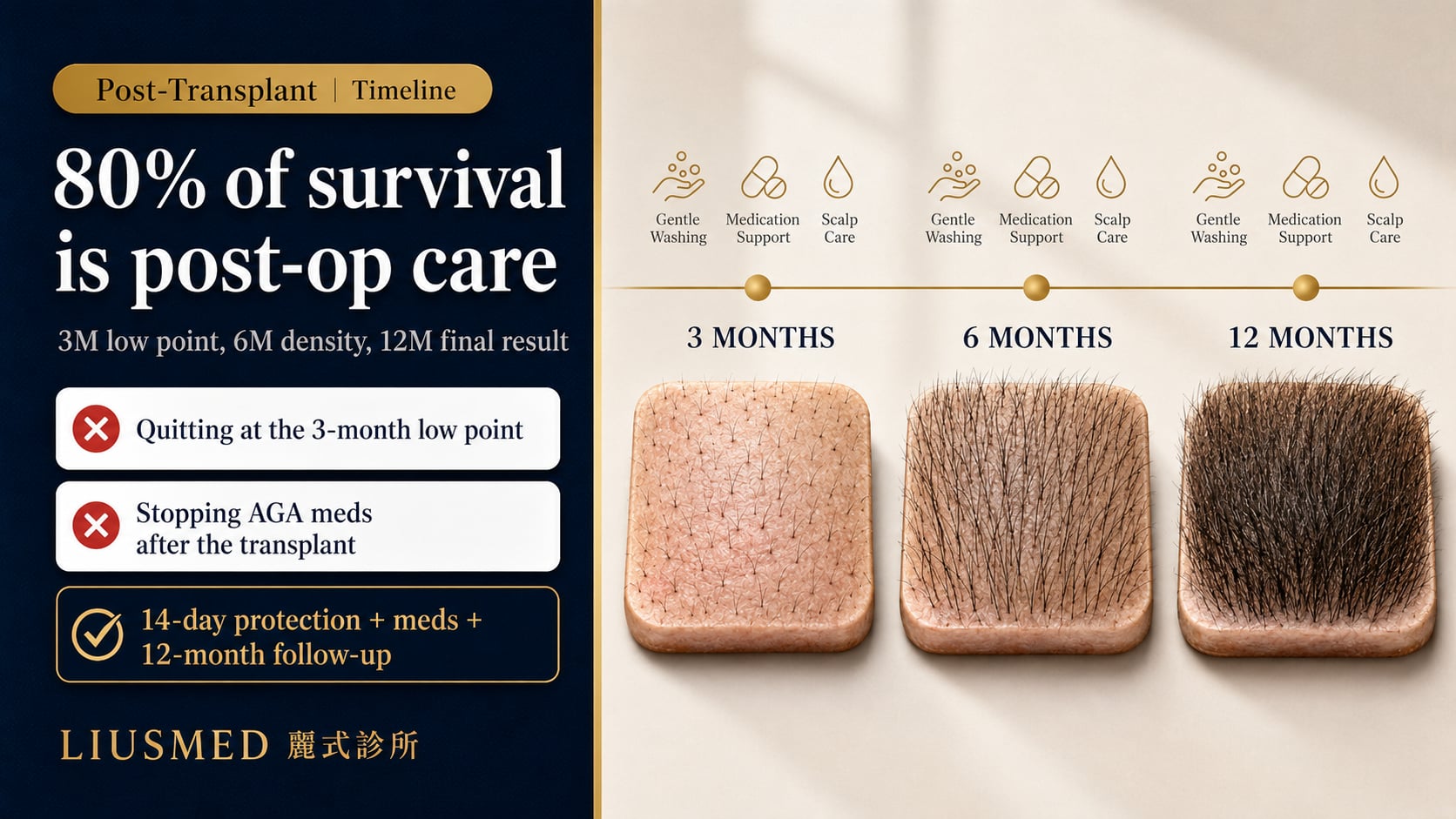 Hair Transplant Aftercare: 3/6/12-Month Checklist (2026)